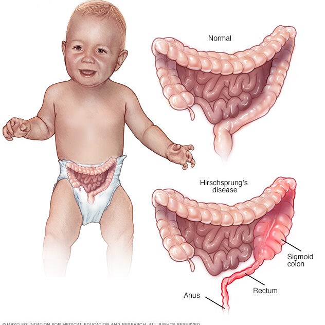 4. Paediatric Gastroenterology